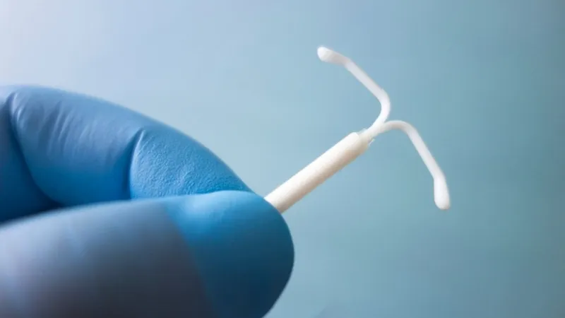 Một IUD có giá bao nhiêu?